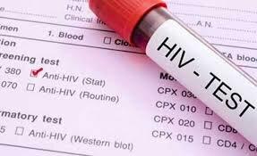 انجام آزمایش اچ آی وی با رضایت آگاهانه برای ۹۸ درصد از خانم های باردار در چهارمحال و بختیاری 