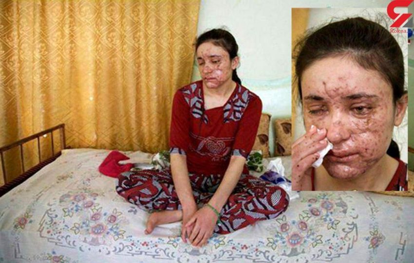 ناگفته دختر فراری از همخوابی های وحشیانه با داعش + عکس