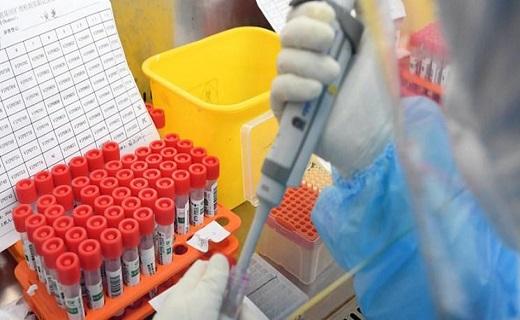 تست‌های تشخیص کرونا ویروس