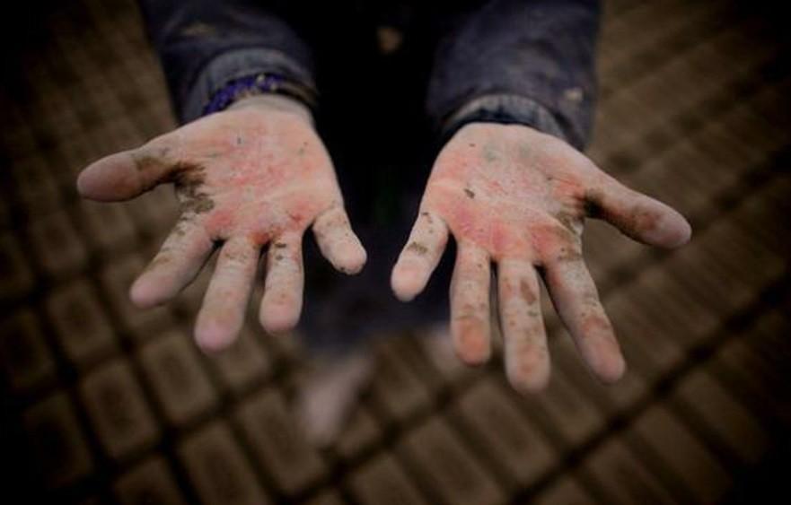 همنشینی کرونا ویروس با زباله گردهای شهر