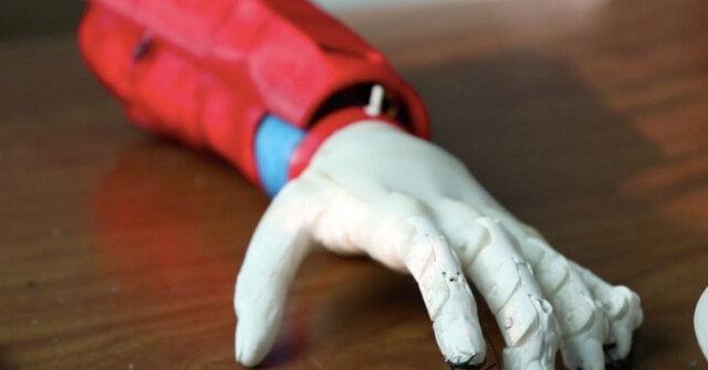 ابداع بازوی مصنوعی خورشیدی برای یک پسر ۸ ساله|خبر فوری