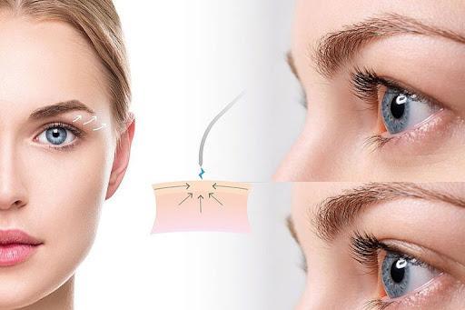 پلاسما تراپی چیست؟