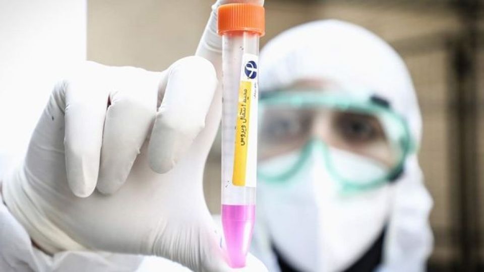 کدام تست برای تشخیص کووید ۱۹ دقیق‌تر است؟