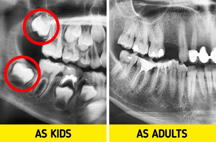 ۵ نشانه ای که ثابت می‌کند بدن انسان به سرعت در حال تکامل است|خبر فوری