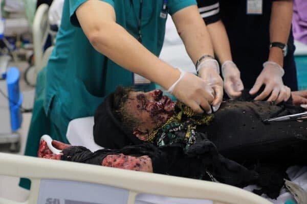 اورژانس تهران: تاکنون ۲۸ مصدوم حوادث چهارشنبه‌سوری داشتیم