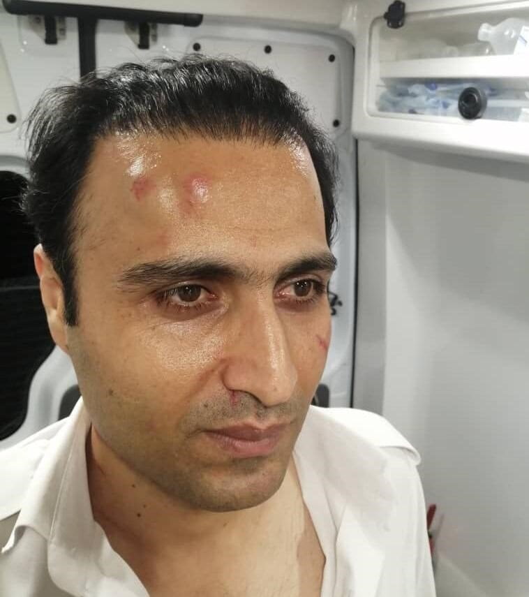 تکنسین اورژانس توسط اراذل مضروب شد/ عکس