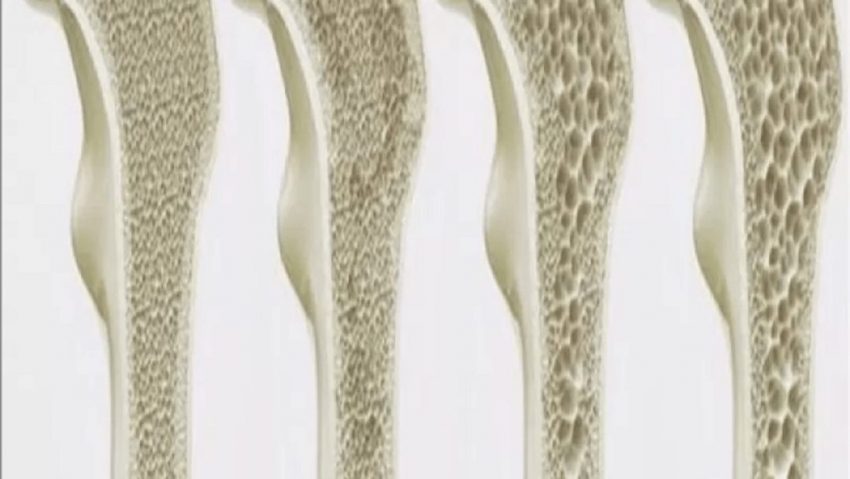 بیماری عجیبی که زنان بیشتر در معرض آن قرار دارند