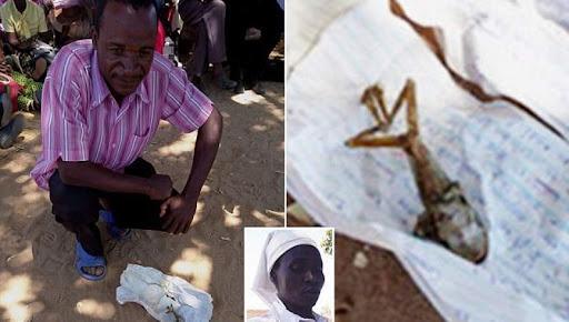 این زن بچه قورباغه به دنیا آورد