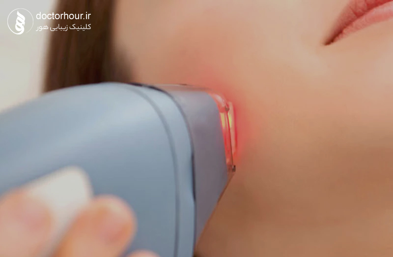بهترین مرکز لیزر موهای زائد در قم